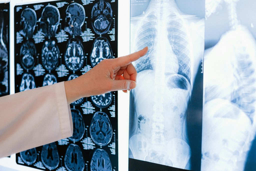 ercetătorii de la MIT au demontat misterul: au arătat că sistemul imunitar comunică direct cu creierul și impune izolarea socială — nu doar ca efect al oboselii, ci printr-un circuit neurologic activ.