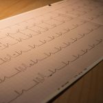 Femeile pot fi expuse mai devreme la riscul bolilor cardiace, arată un studiu recent