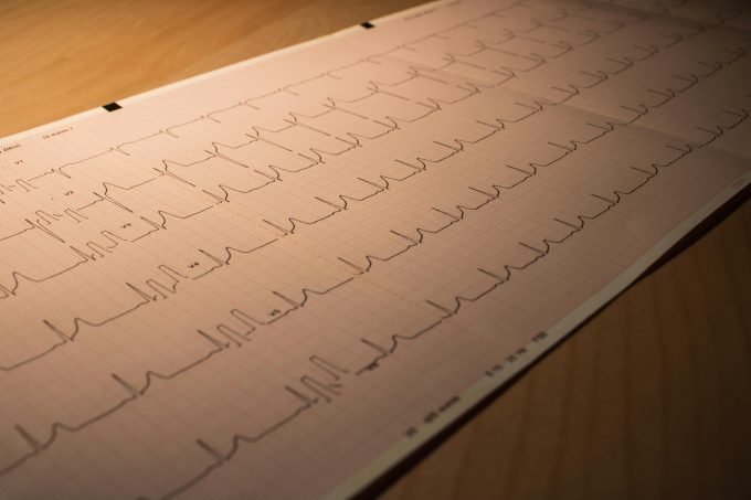 Femeile pot fi expuse mai devreme la riscul bolilor cardiace, arată un studiu recent