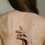 Studiu: Un plasture inteligent cu ioni de cupru ar putea trata melanomul fără operație