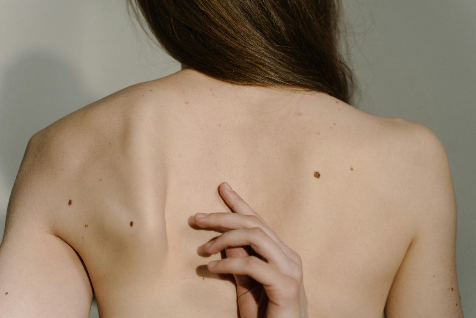 Studiu: Un plasture inteligent cu ioni de cupru ar putea trata melanomul fără operație