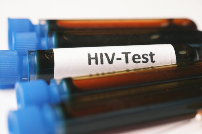 Studiu: o singură terapie celulară ar putea controla infecția cu HIV. Cum funcționează tratamentul experimental