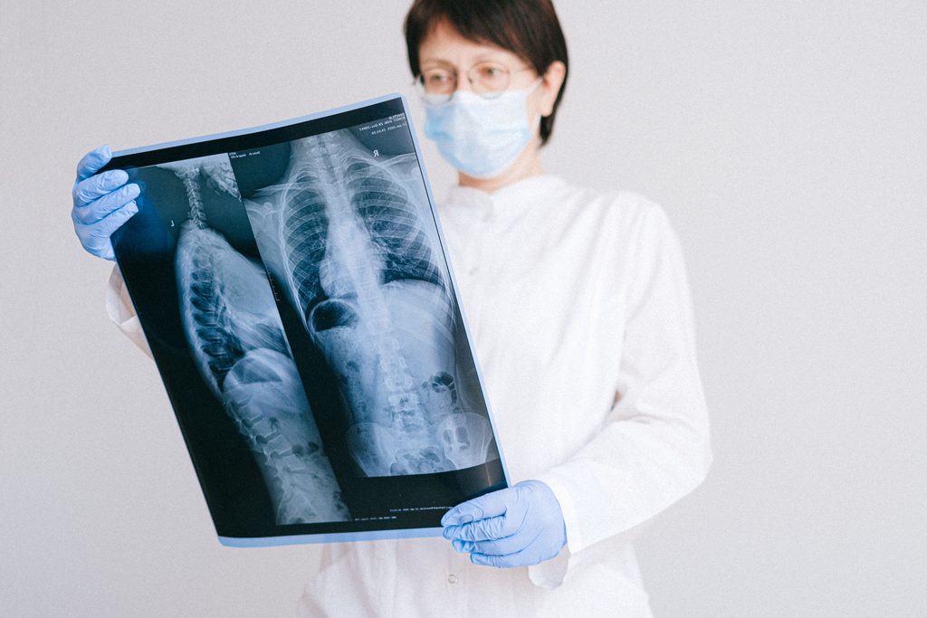 Silicoza revine în rândul muncitorilor. Boala pulmonară poate fi prevenită, dar continuă să provoace decese