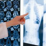 Silicoza revine în rândul muncitorilor. Boala pulmonară poate fi prevenită, dar continuă să provoace decese